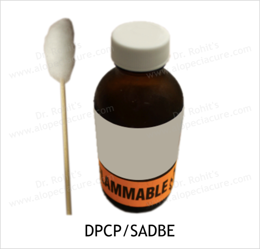 DPCP / SADBE